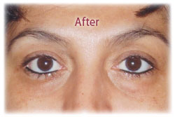 eye makeup